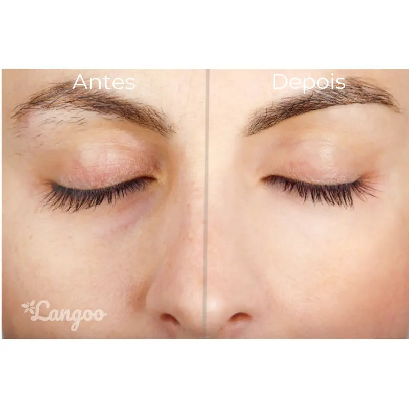 Kit Beleza LuxDepil® - 2 Canetas Depiladoras Sobrancelhas Facial & Corporal